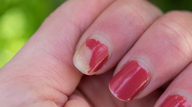 woman's hand with chipped nail polish