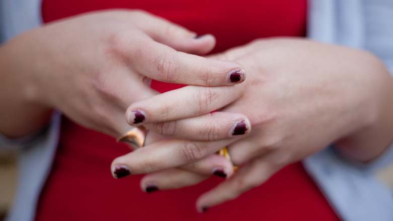 woman with chipped nail polish