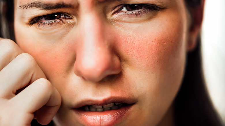 woman with redness face