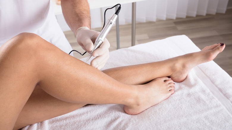 microneedling on legs dermatologist in office treatment