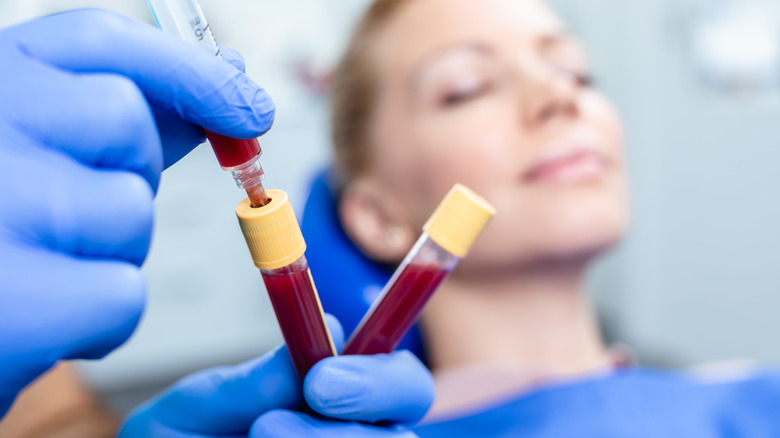 doctor gloves holding blood vials woman patient