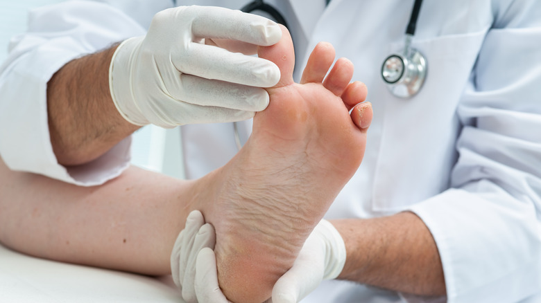 doctor examining athlete's foot 