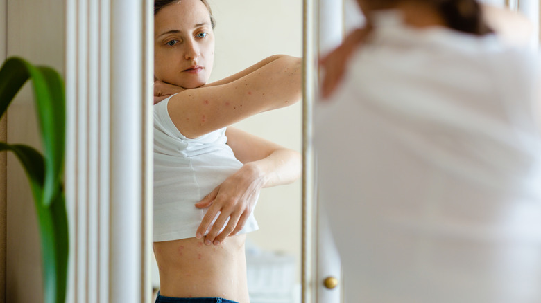 A woman looking at her psoriasis