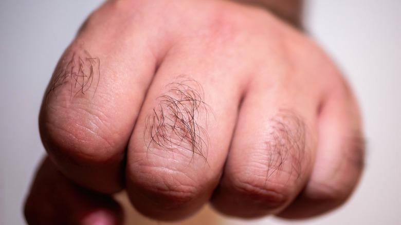 hairy knuckles