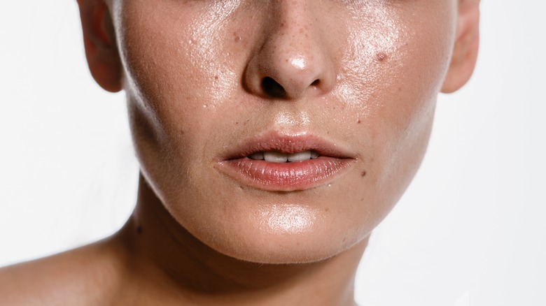 Woman with oily skin