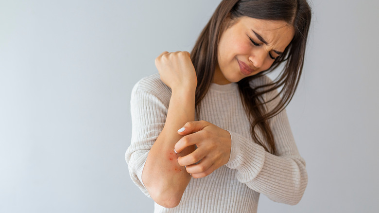 woman scratching irritated skin