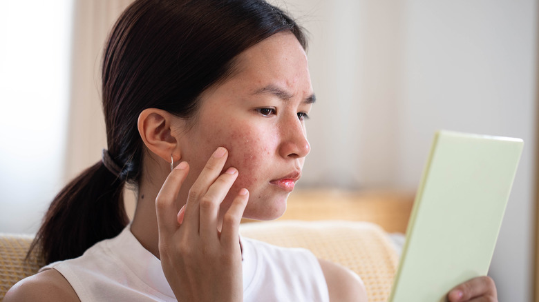 Woman touching acne on face