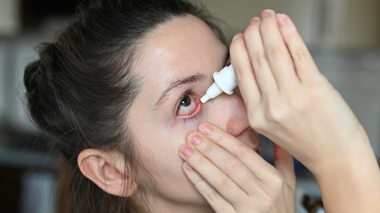 A woman using eye drops