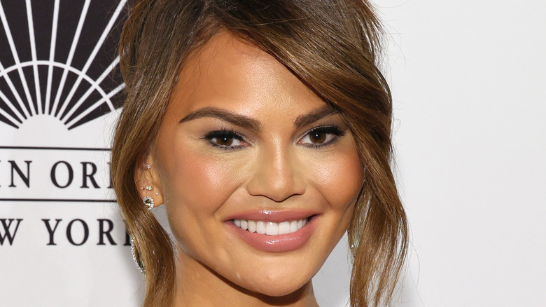 Chrissy Teigen plastic surgery