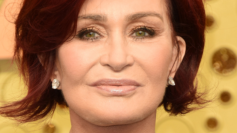 Sharon Osbourne plastic surgery