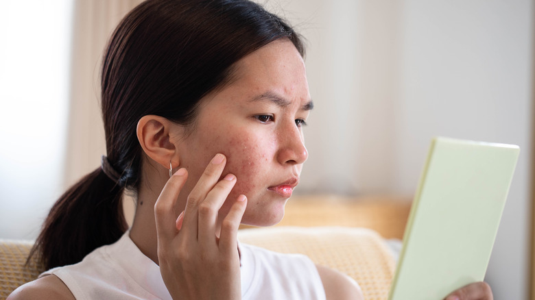 Woman touching inflamed pimples