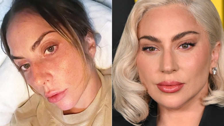 Side-by-side of Lady Gaga without makeup and styled on the red carpet.