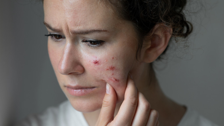 Woman with skin issues