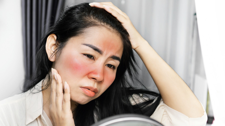 Woman with skin redness, irritation