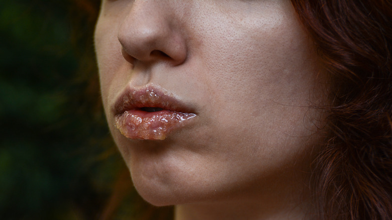 Girl with homemade scrub applied on lips