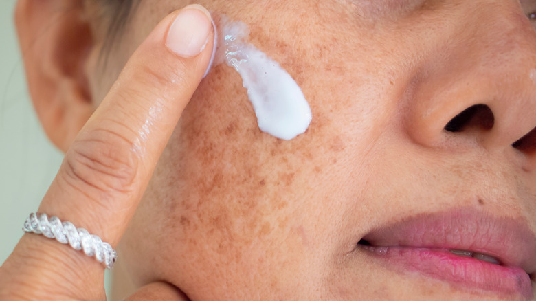 Model applying cream to face for melasma