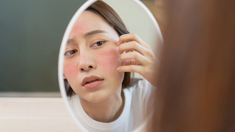 Woman examines rosacea in mirror