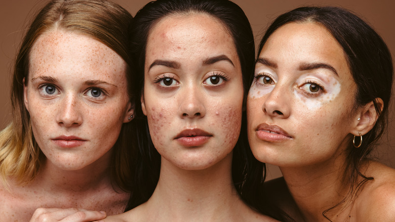 Three women with different skin