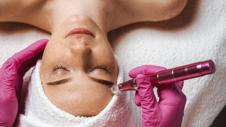 Microneedling procedure on eyebrow