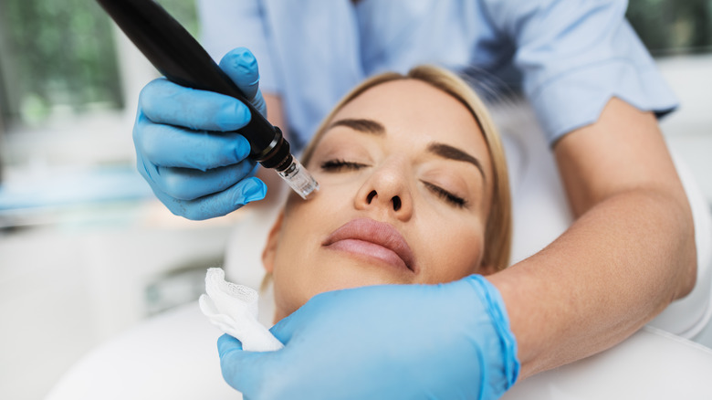 Microneedling procedure on woman's cheek