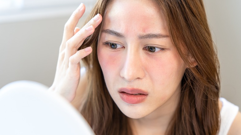 Rash on a woman's face