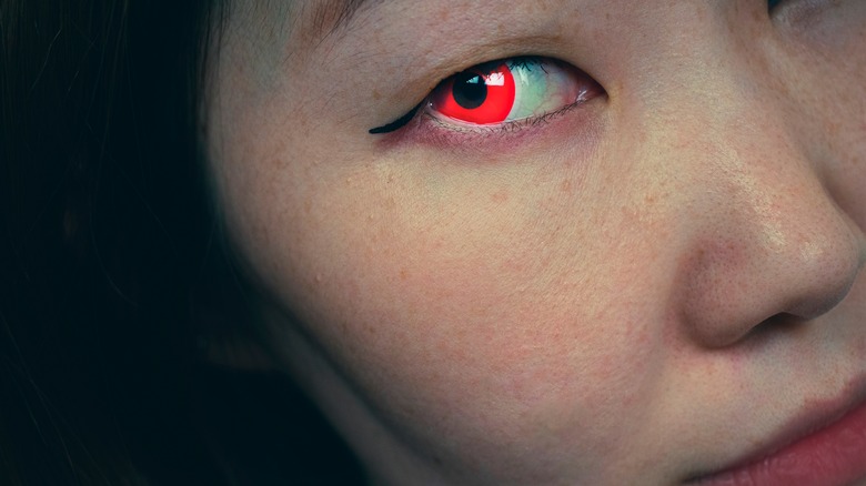 Are Colored Eye Contacts Safe?