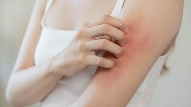 Woman with dry skin patch on arm