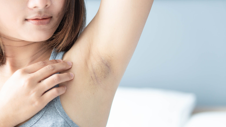 woman growing underarm hair