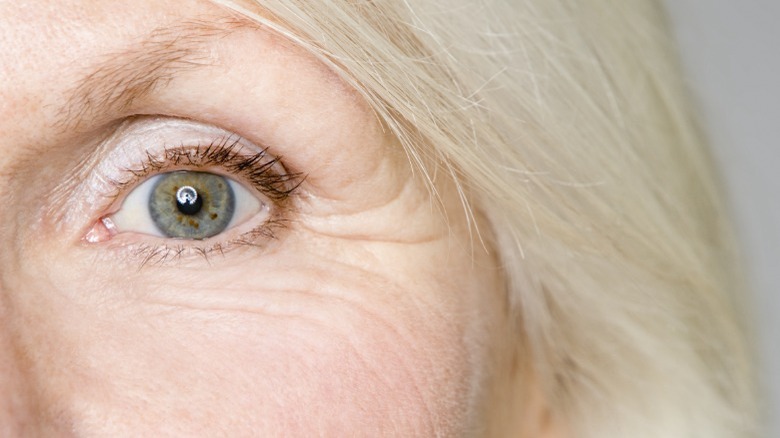 Close-up of a woman with wrinkles around her eye