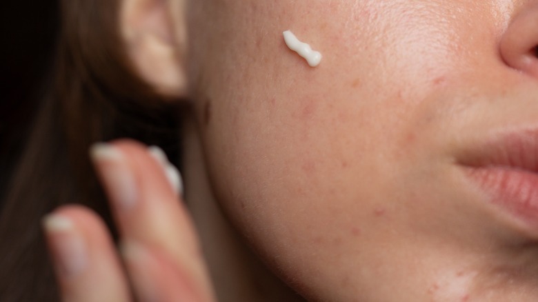 Can Antidepressants Cause Skin Issues?