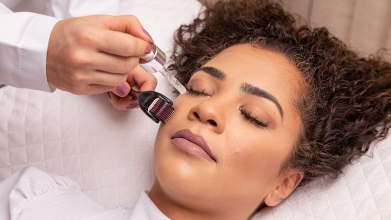 Woman getting microneedling 