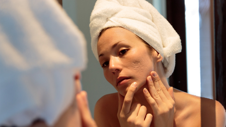 woman looking at acne scars