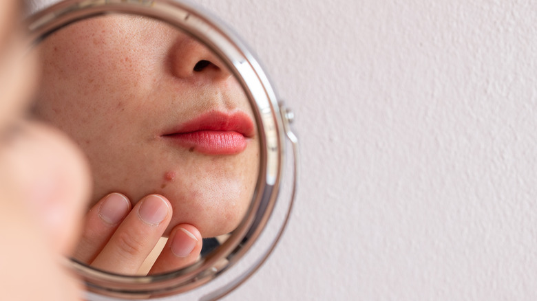 Person examining skin in front of mirror