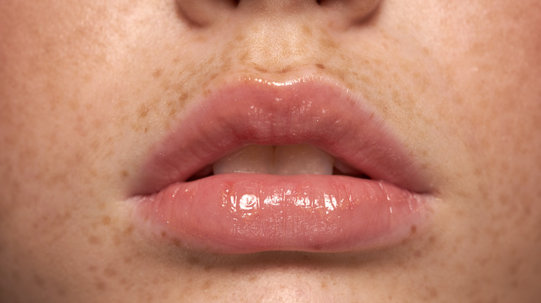 Close-up of lips with filler