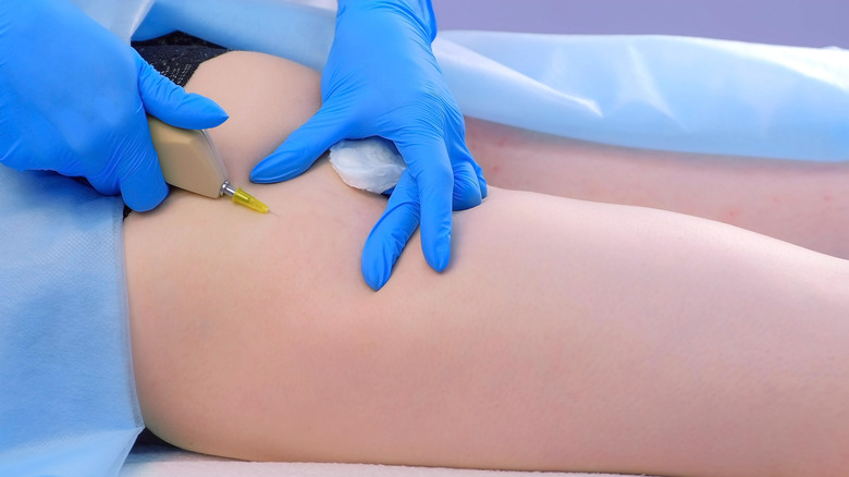 Woman getting carboxytherapy injections