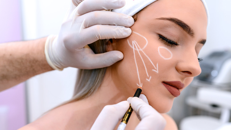 surgeon drawing lines on face