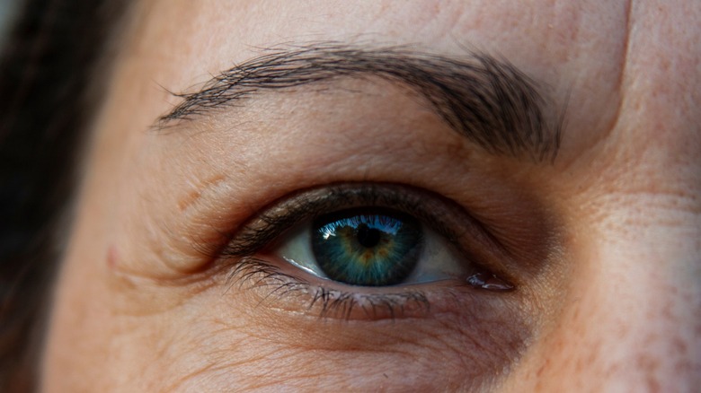 Woman with tadpole eyebrow