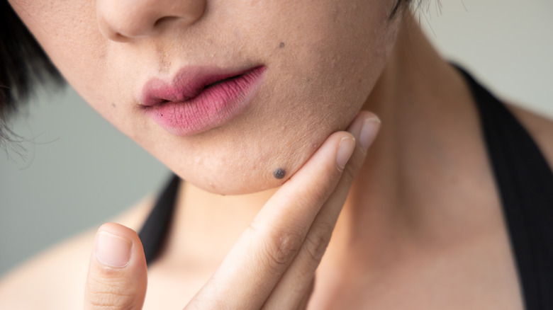 young adult woman touching mole on chin