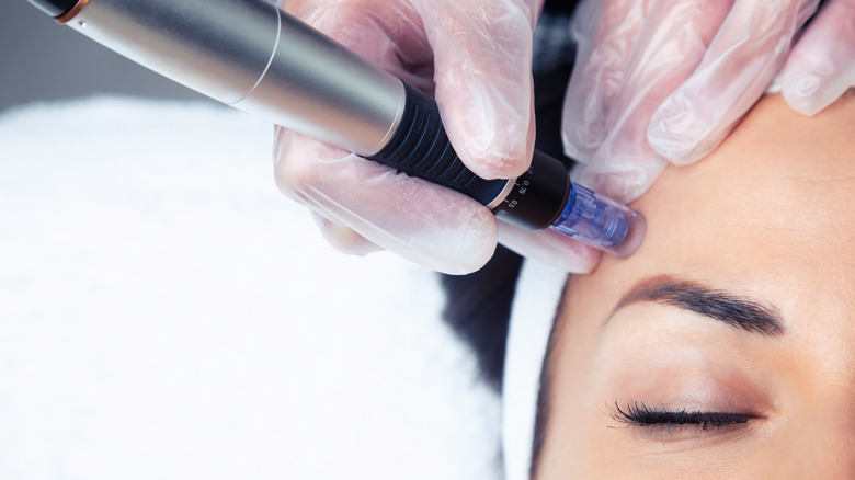 derma pen being applied to woman's forehead