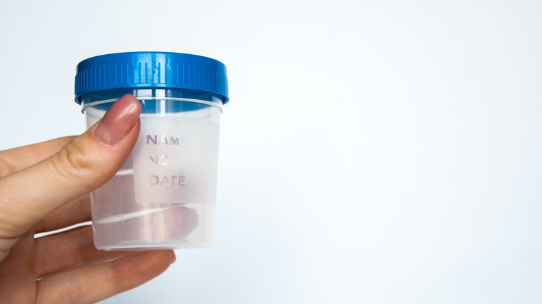 Urine sample cup