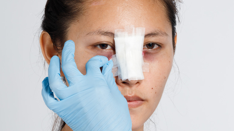 rhinoplasty nose splint bandages
