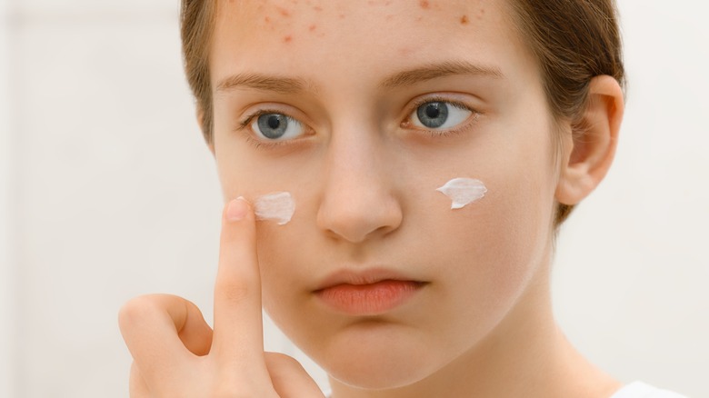 apply cream to acne