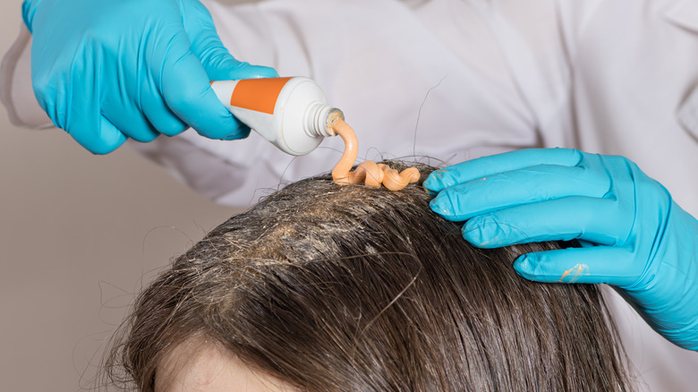 Solution being applied to scalp