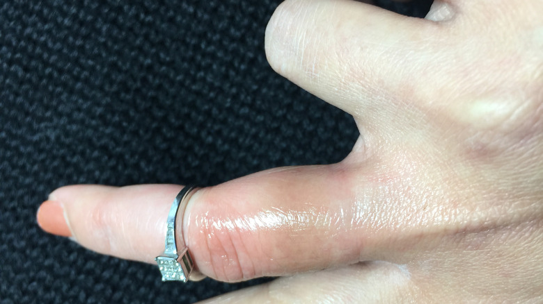 person's finger with enagement ring