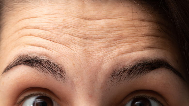 woman scrunching forehead wrinkles