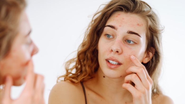 Woman examining blemished skin