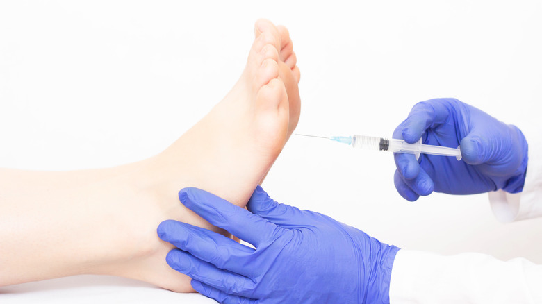 botox infection in foot