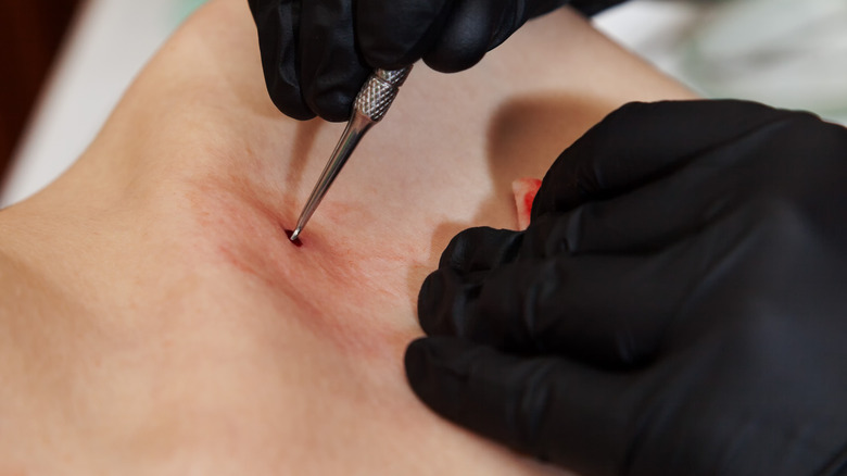 Dermal piercing procedure 