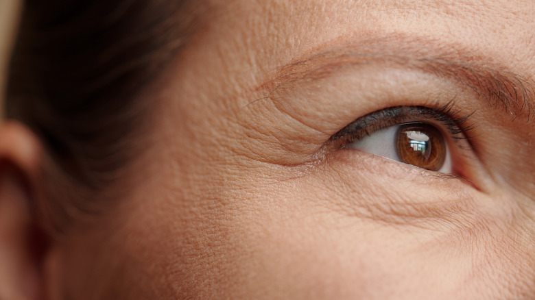 Woman with crow's feet wrinkles