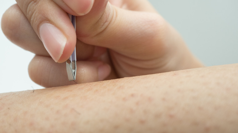 woman plucking ingrown hair with tweezers